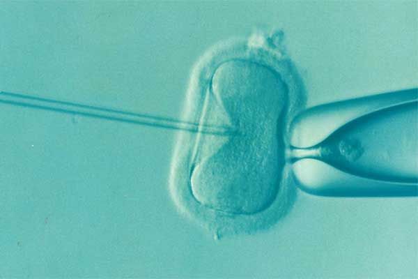 IVF Lawsuit Filed in North Carolina Over CooperSurgical’s Defective Growth Solution